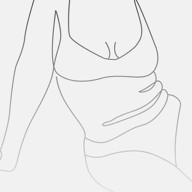 Body contouring - 3