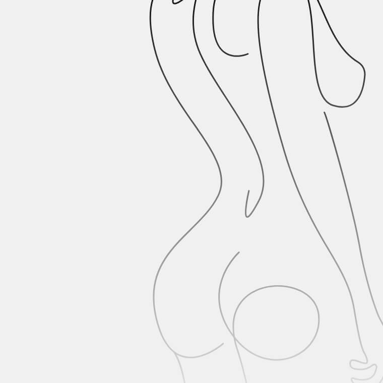 Body contouring - 4